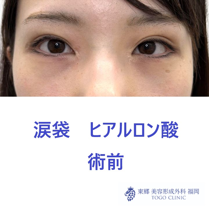 IMG_4888_20250811144432_0_R