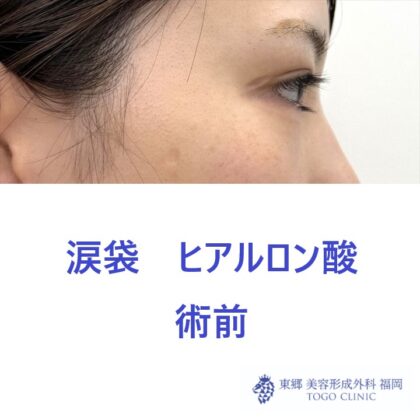 IMG_4891_20250811144435_3_R