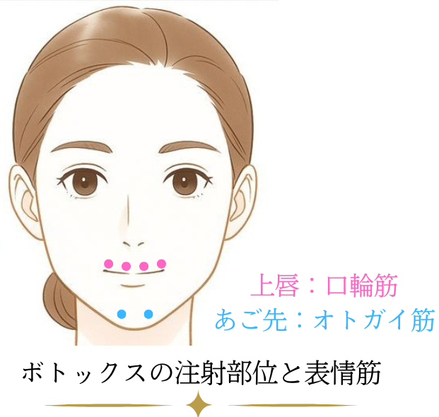 唇のシワ、梅干しジワのデザイン