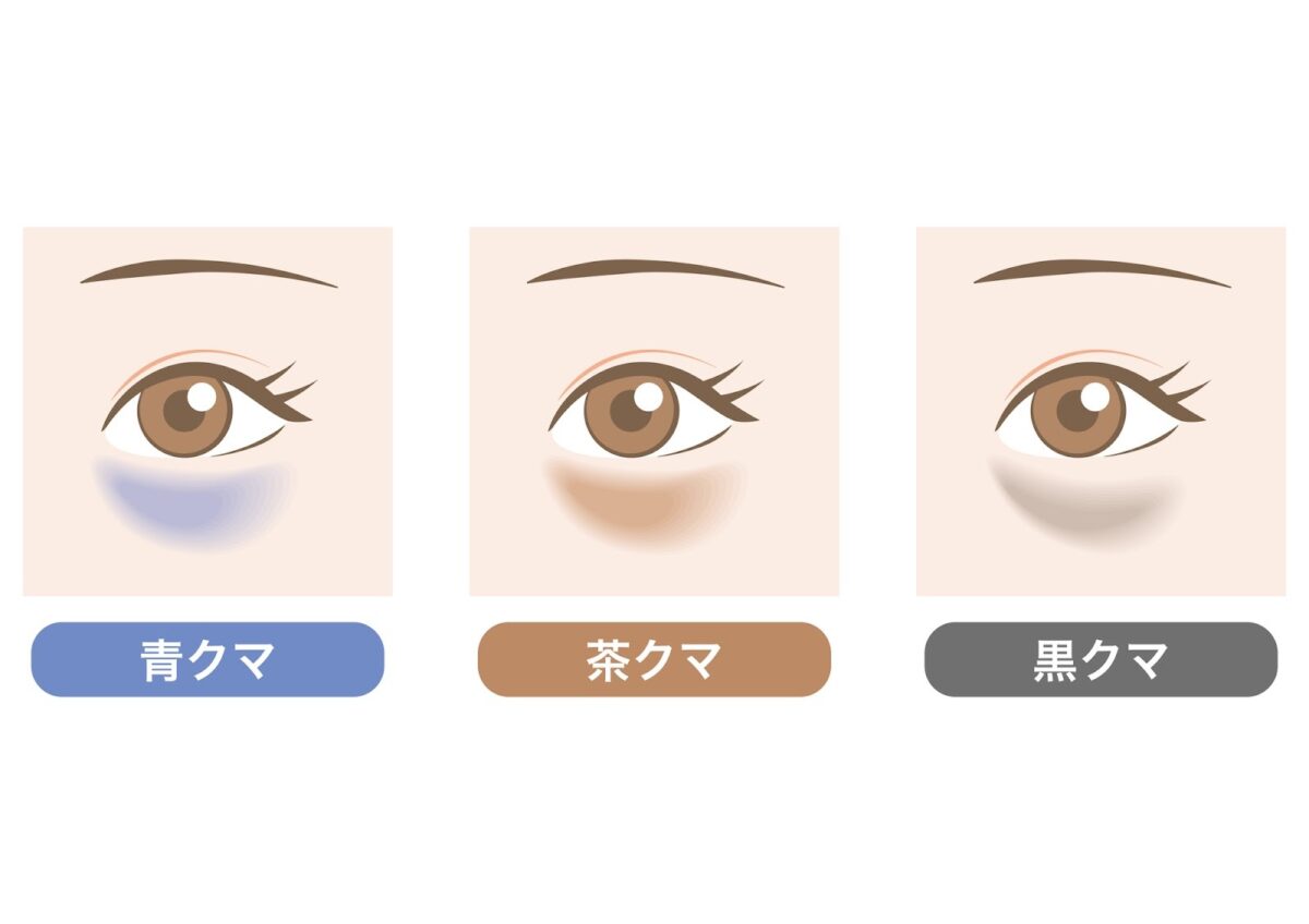 クマの種類をさらに詳しく解説