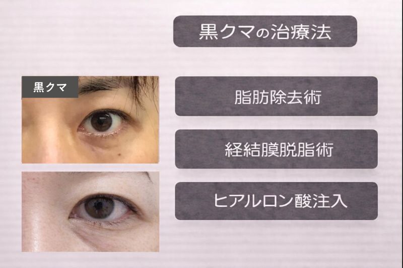 黒クマの治療方法