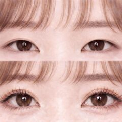 二重整形はバレバレ？不自然に見える原因とバレにくい二重を作る方法