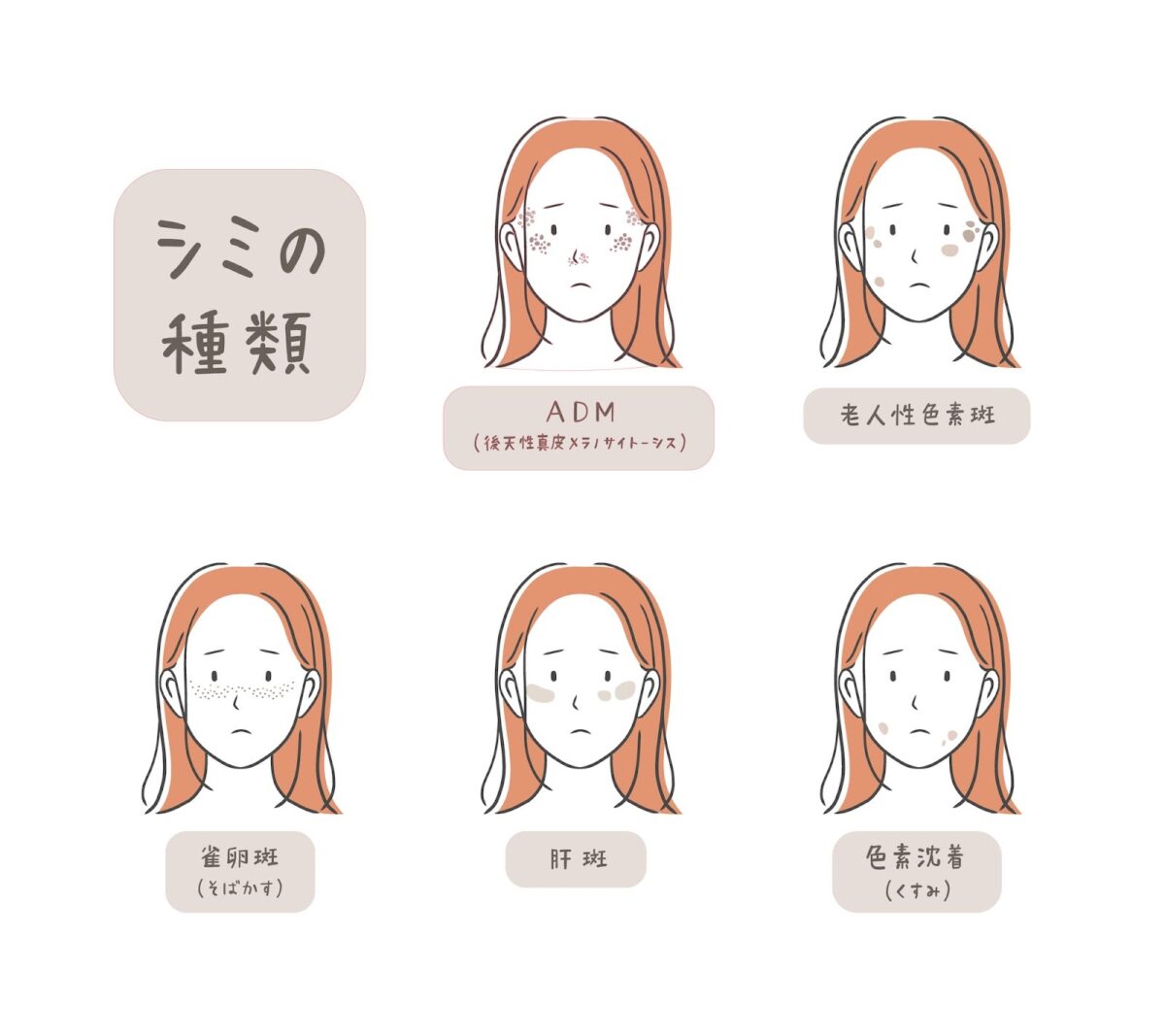肝斑・シミの基本的な見分け方