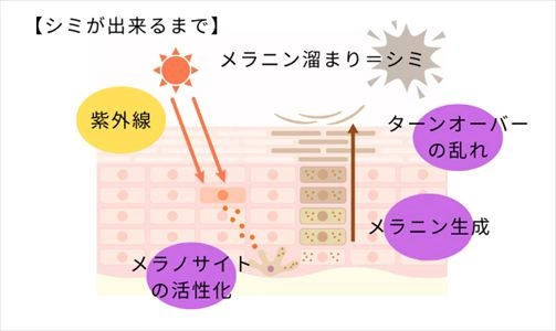 肝斑とシミはできる原因や発生のメカニズムが異なる