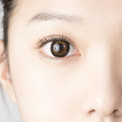 目の左右差がひどい原因と改善方法｜二重整形で解消できる？