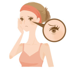 クマ取りのダウンタイムはどれくらい？当日～7日目の経過を分かりやすく解説